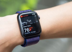 Why Everyone Wants the New Apple Watch